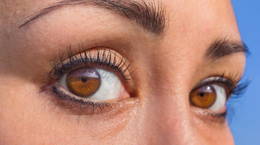 Son d&ouml;nemin en pop&uuml;ler estetiği badem g&ouml;z estetiği 