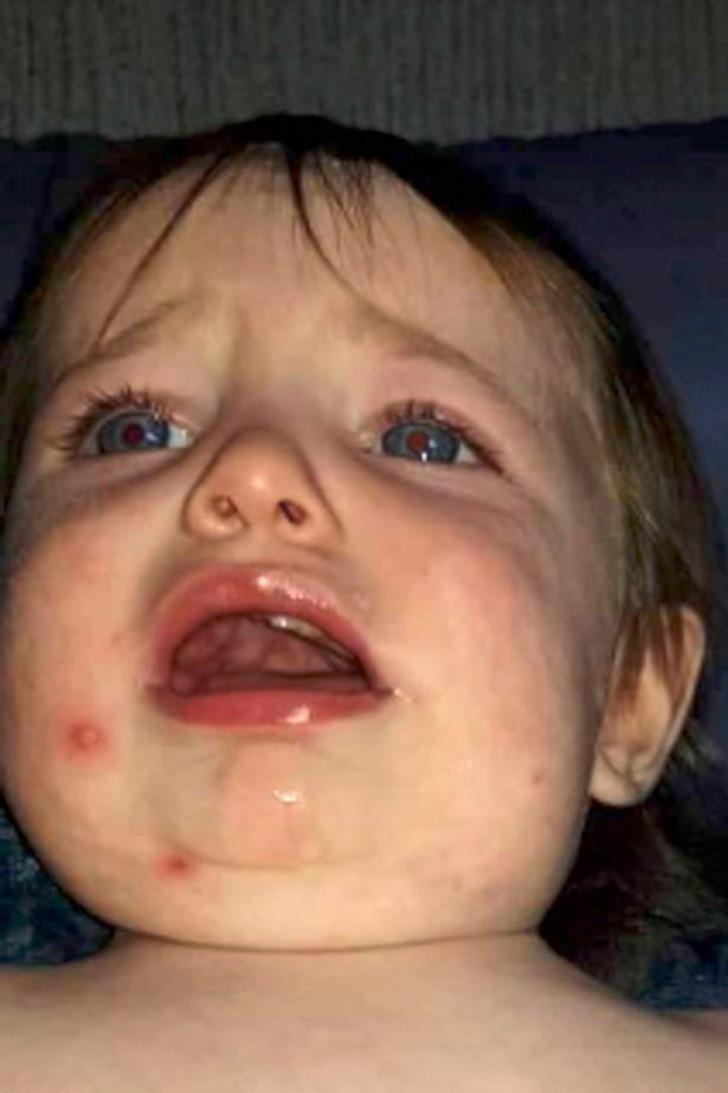 Öpmeyin, öptürmeyin! Küçük bir öpücük bebeğin hayatına mal oluyordu G2