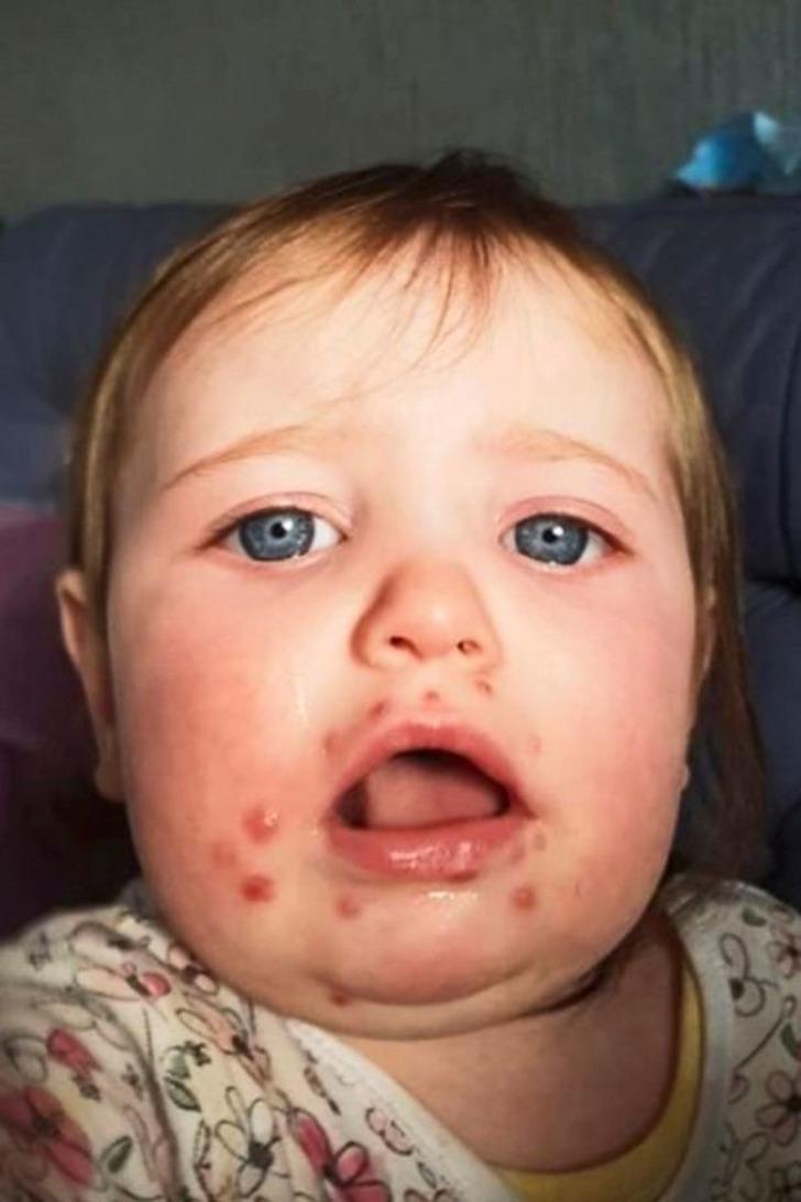 Öpmeyin, öptürmeyin! Küçük bir öpücük bebeğin hayatına mal oluyordu G4