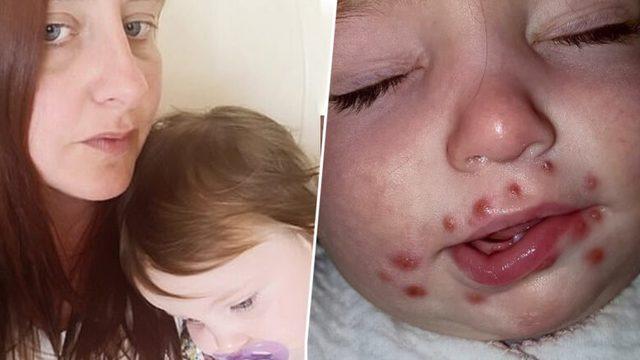 Öpmeyin, öptürmeyin! Küçük bir öpücük bebeğin hayatına mal oluyordu