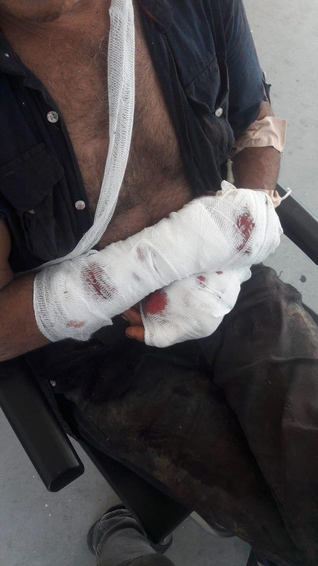 Pitbull sahibine saldırdı, polis vurarak kurtardı 2