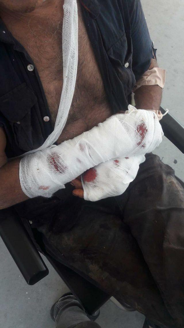  Pitbull yanlış yetiştirme nedeniyle saldırganlaşır  3