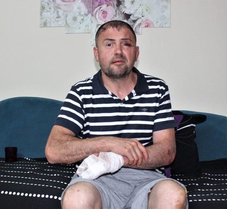 Bursa'da yüzde 92 engelli gaziye dayak! Tutuklandılar G2