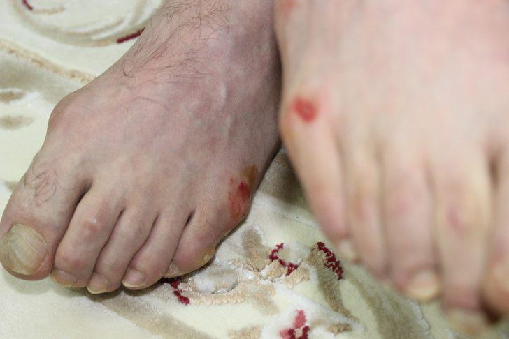 Bursa'da yüzde 92 engelli gaziye dayak! Tutuklandılar G3