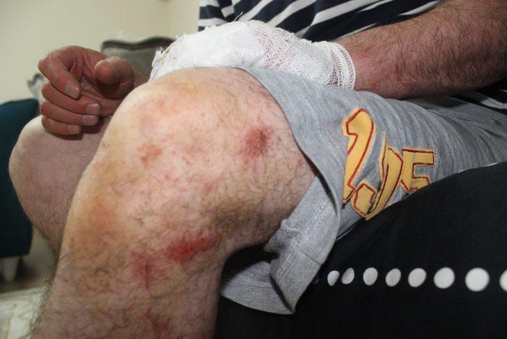 Bursa'da yüzde 92 engelli gaziye dayak! Tutuklandılar G4