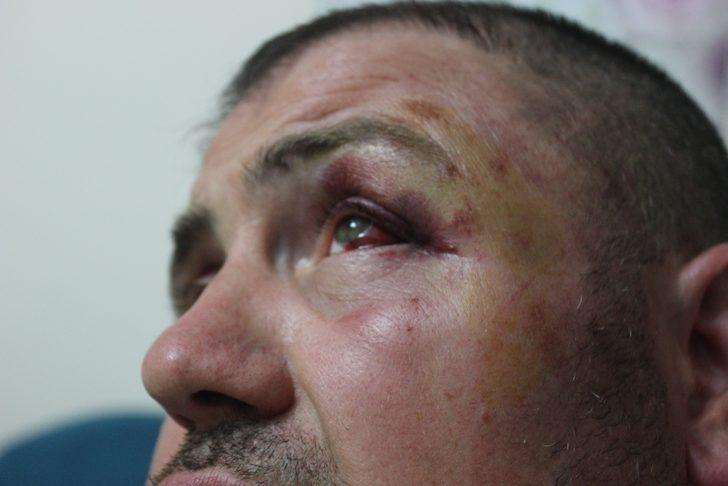 Bursa'da yüzde 92 engelli gaziye dayak! Tutuklandılar G1