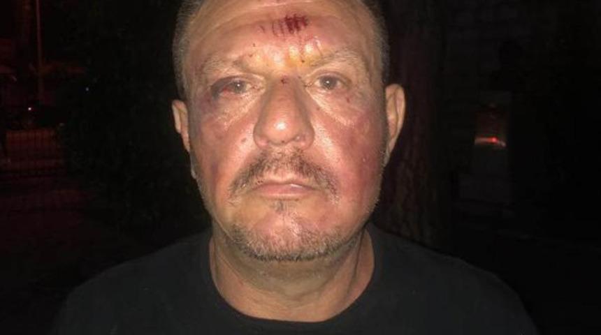 Muğla Valiliği'nden Ali Çetin'in darp edildiği iddialarına açıklama