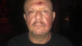 Muğla Valiliği'nden Ali Çetin'in darp edildiği iddialarına açıklama