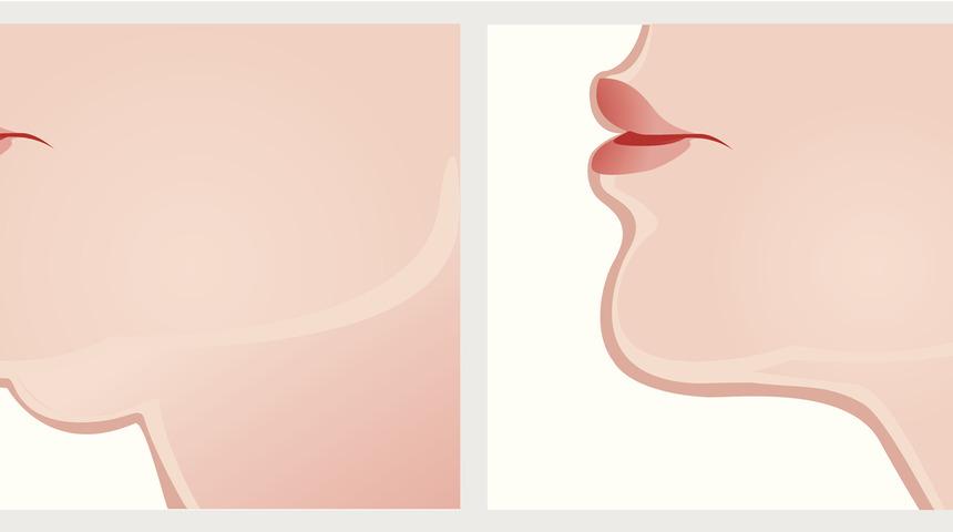 Gıdı ve kol bölgenizdeki inatçı yağlardan kurtulabilirsiniz