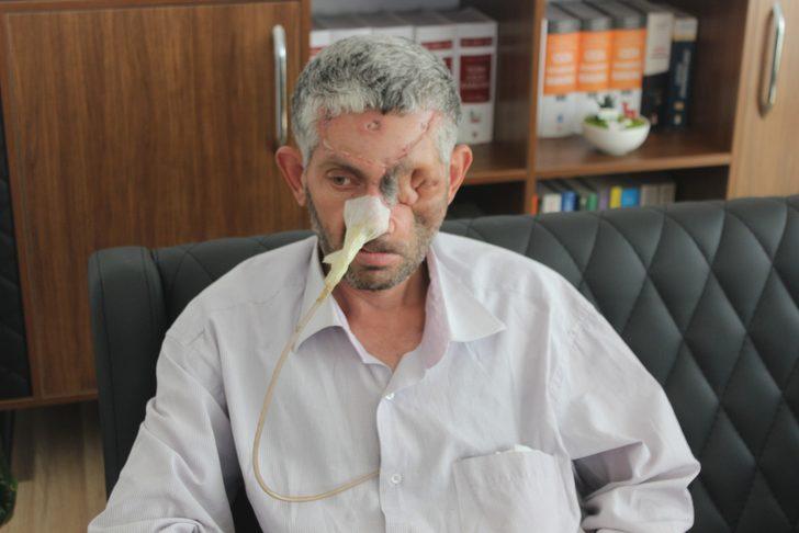 'Dişini çektirdikten sonra gözünü kaybetti' iddiası G1