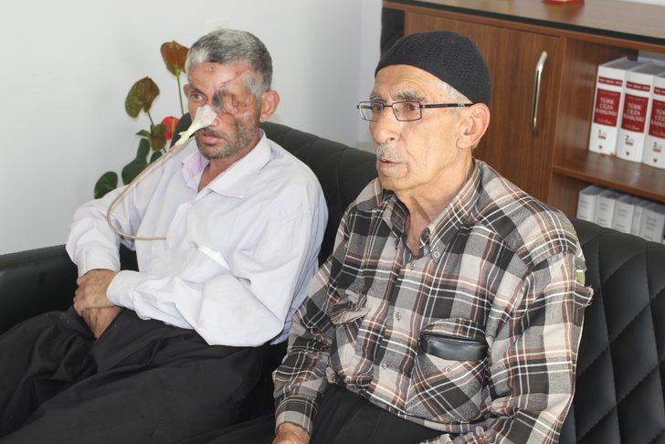 'Dişini çektirdikten sonra gözünü kaybetti' iddiası G2