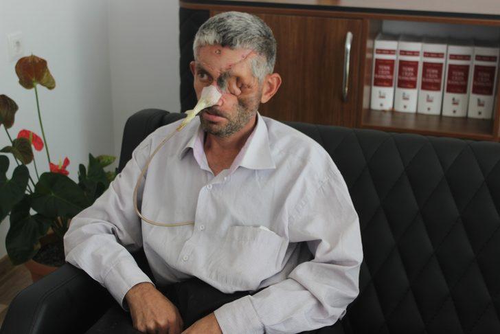 'Dişini çektirdikten sonra gözünü kaybetti' iddiası G3