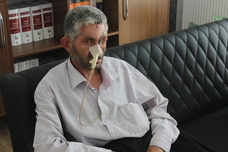 'Dişini çektirdikten sonra gözünü kaybetti' iddiası G4