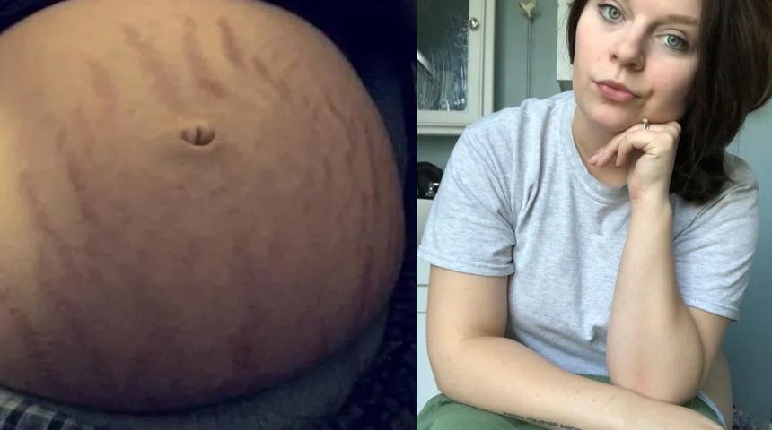 Gebeliğin komik gerçekleri! Kimi vücut çatlaklarını, kimi de şişmiş ayaklarını paylaşıyor