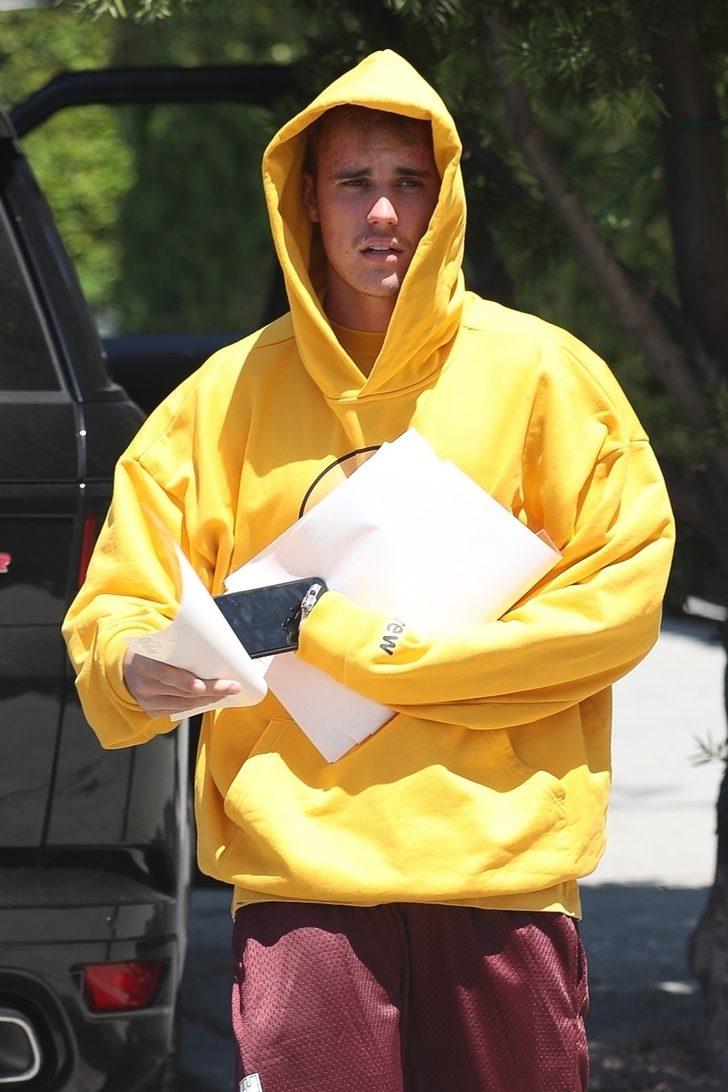 Justin Bieber'ın yüzünü sivilce bastı G2