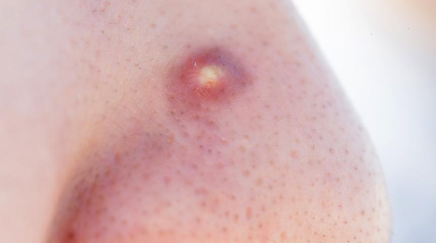 Hepimiz yapıyoruz artık iki kere düşüneceksiniz! 'Ölüm üçgeni', felce hatta ölüme bile yol açabiliyor