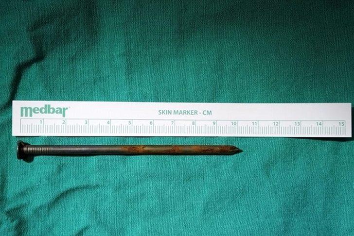 Nefes darlığı şikayetiyle gitti, hayatının şokunu yaşadı! G2