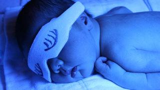 Her 10 bebeğin 6'sında sarılık görülüyor