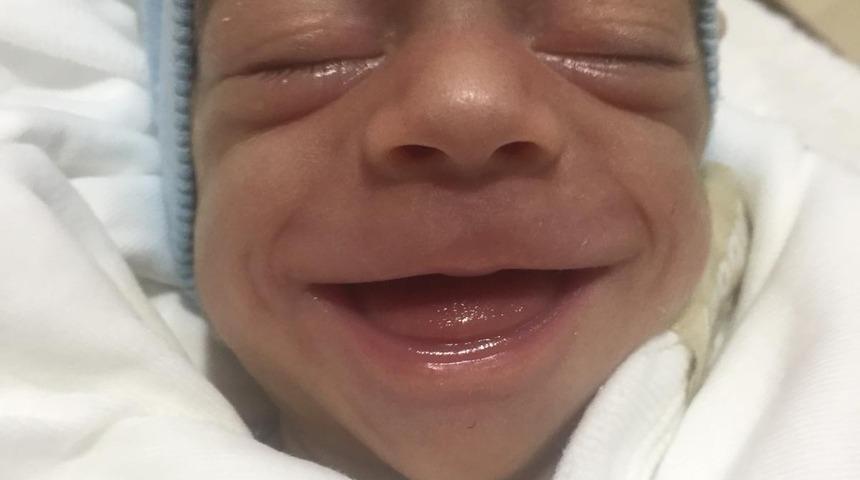 Bin 40 gram olarak dünyaya gelen doğuştan mücadeleci bebek 