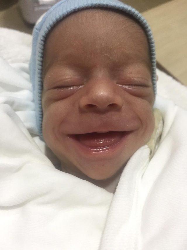 Bin 40 gram olarak dünyaya gelen doğuştan mücadeleci bebek