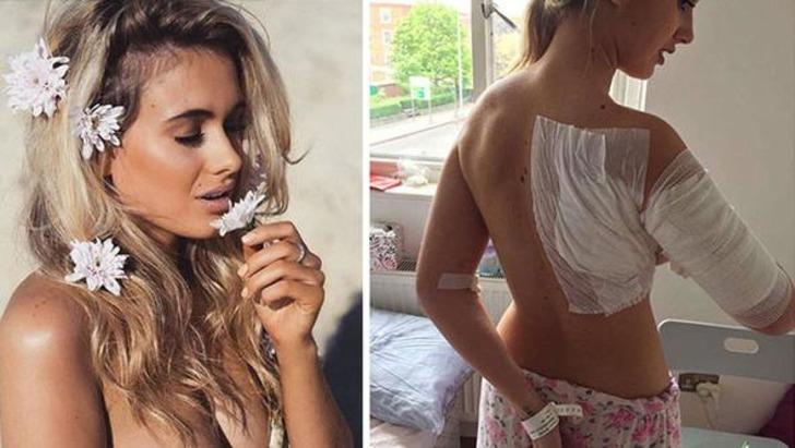 Gece kulübünde asit dehşeti! Genç model bu hale geldi G1