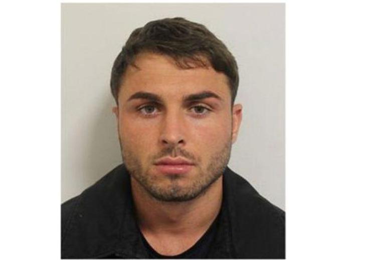 Gece kulübünde asit dehşeti! Genç model bu hale geldi G3