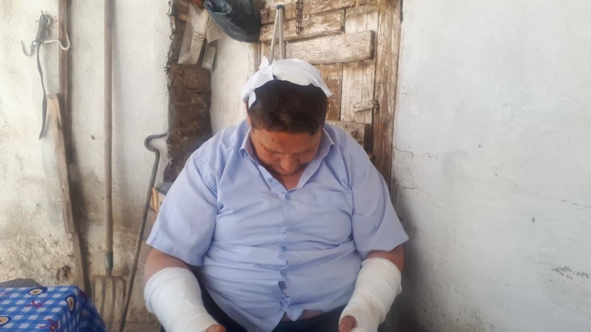 Eniştelerini hastanelik edinceye kadar d&ouml;vd&uuml;ler