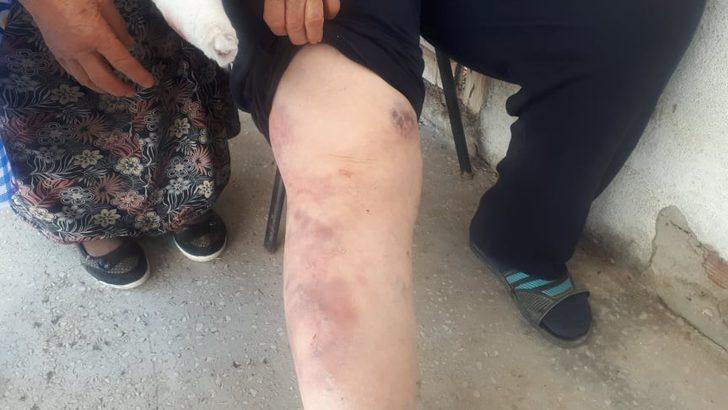 Eniştelerini hastanelik edinceye kadar dövdüler G2