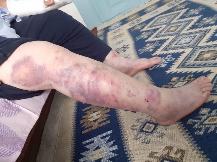 Eniştelerini hastanelik edinceye kadar dövdüler G5