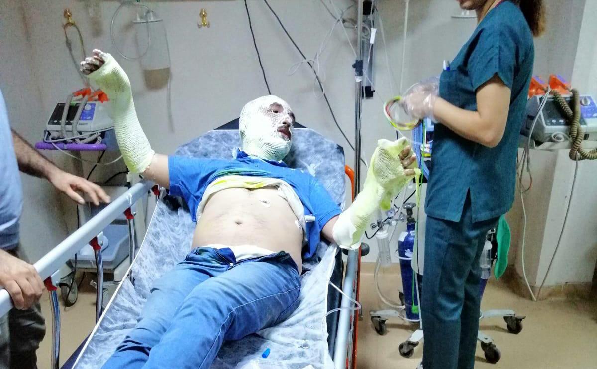 MHP İl&ccedil;e Başkanı teknede &ccedil;ıkan yangında ağır yaralandı