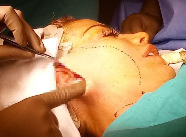 İngiliz şarkıcı Katie Price estetik için Türkiye'de!  G3