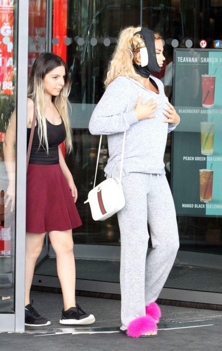 İngiliz şarkıcı Katie Price estetik için Türkiye'de!  G5