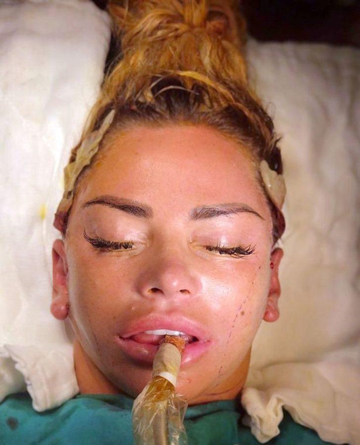 İngiliz şarkıcı Katie Price estetik için Türkiye'de!  G2