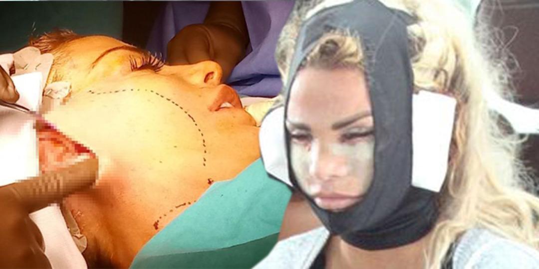 İngiliz şarkıcı Katie Price estetik i&ccedil;in T&uuml;rkiye'de! 