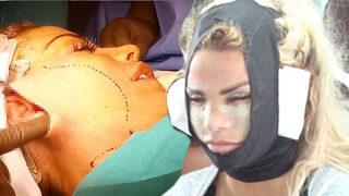 İngiliz şarkıcı Katie Price estetik için Türkiye'de! 