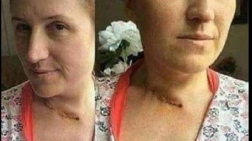 Eski sevgilisinin bıçakladığı Tuba'dan, Emine Bulut cinayetiyle ilgili 'video' tepkisi