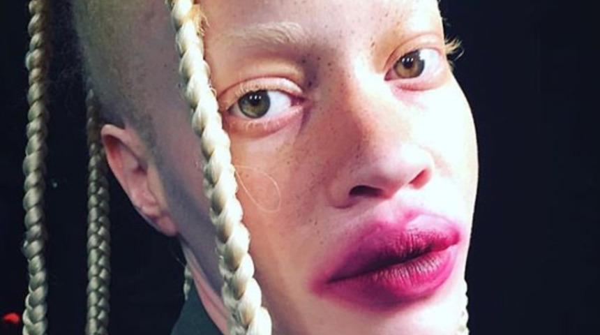 Bir zamanlar alay edilen kadın şimdi güzelliğiyle herkesi büyülüyor