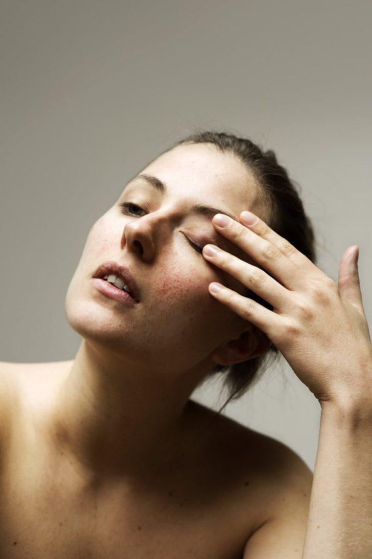 Makyaj yok, filtre yok! Kadınlar 'kusurlu' cildin damgalanmasına meydan okuyor  G5