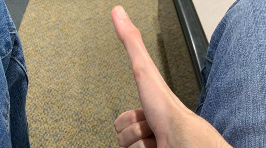 Bu nasıl parmak? Fenomen oldu