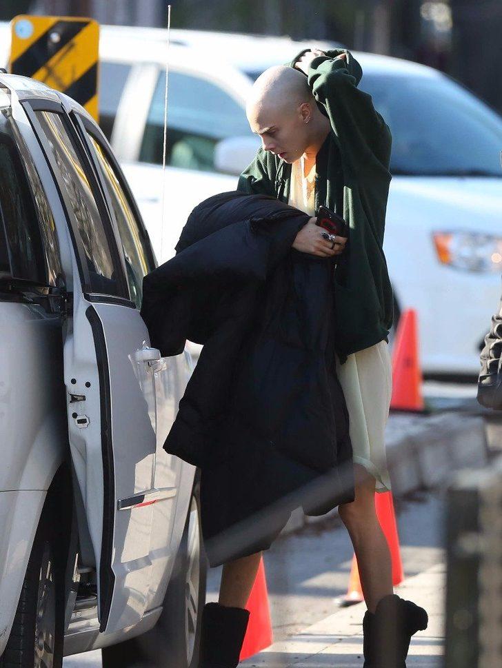 Cara Delevingne son haliyle şoke etti G5