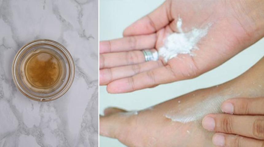 Hayatı Zindana &Ccedil;eviren Nasırdan Kurtulmanızı Sağlayacak 10 Doğal Y&ouml;ntem