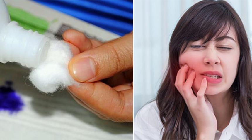 Diş Ağrılarını Evde Ge&ccedil;irebileceğiniz 12 Doğal Y&ouml;ntem