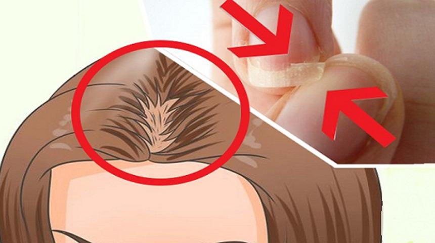 Uykuda Tırnaklarınız Kırılıyor Saçlarınız Dökülüyorsa Bilmeniz Gereken Şeyler Var! 