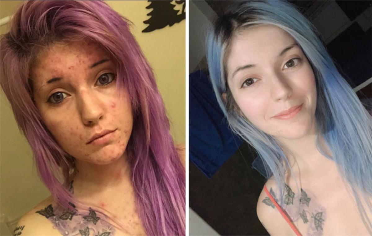 Y&uuml;z&uuml; mayın tarlası gibiydi! B&uuml;y&uuml;k değişimin sırrını a&ccedil;ıkladı