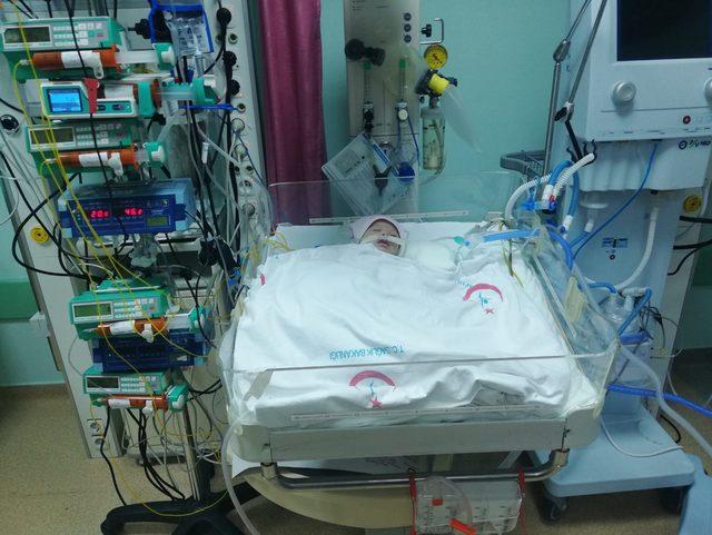 Kalp damarları ters doğan Hayat bebek, hayata tutundu 1