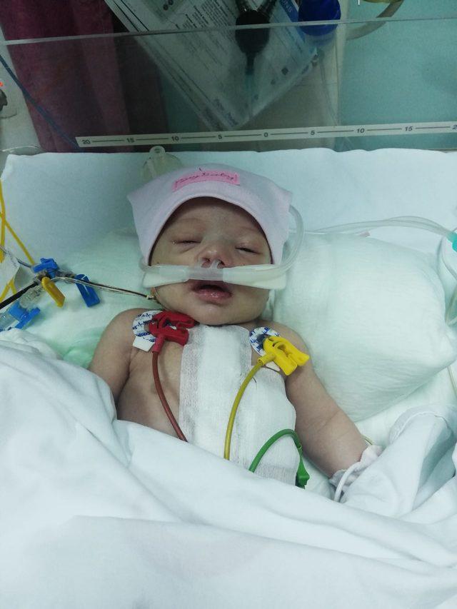 Kalp damarları ters doğan Hayat bebek, hayata tutundu 2