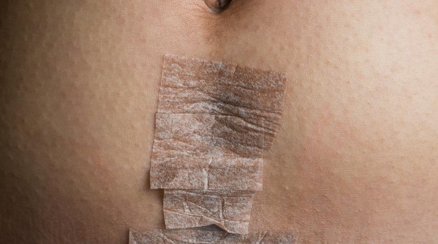 Sezaryen ile doğan bebekler daha sık hasta oluyor