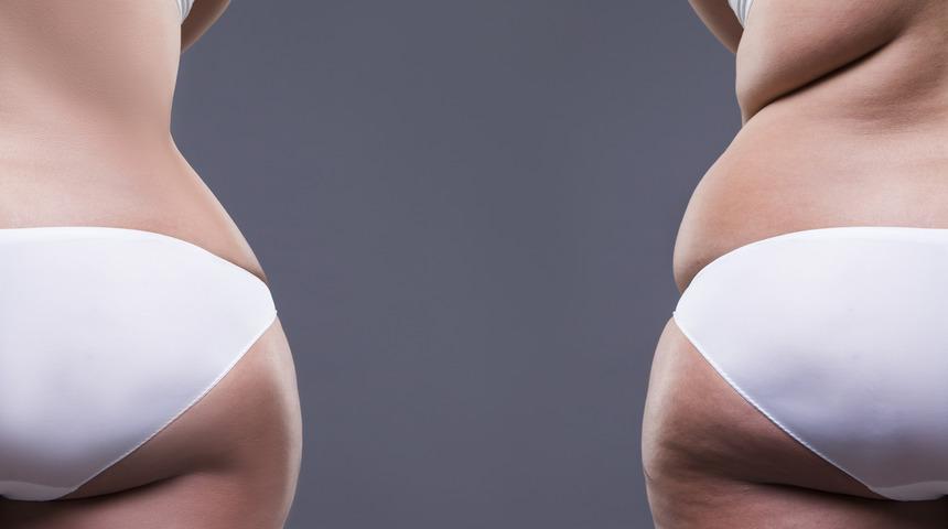 Estetik ameliyatlar aile bütünlüğüne de katkı sağlıyor