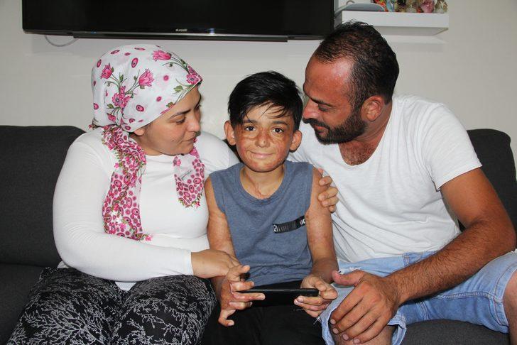 Doktorlar 'yaşama şansı yüzde 1' demişti! Umut’un acı çığlığı: Eski derimi istiyorum G3