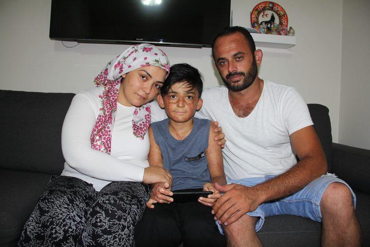 Doktorlar 'yaşama şansı yüzde 1' demişti! Umut’un acı çığlığı: Eski derimi istiyorum G5